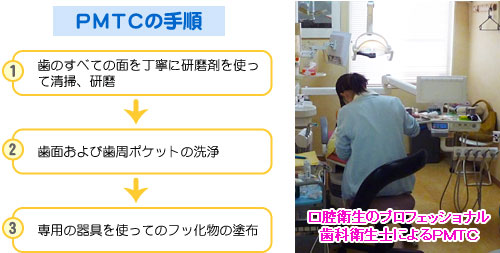 ＰＭＴＣの手順