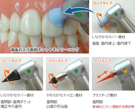 歯を磨くＰＭＴＣアタッチメント