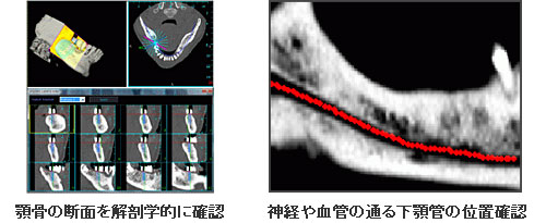 ＣＴ撮影