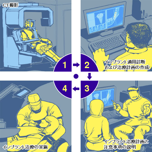 ＣＴ検査からインプラント治療までの流れ