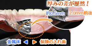 義歯・入れ歯 / 志免 博多 福岡 「しらしげ歯科医院」